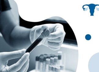 Лечение эндометриоза