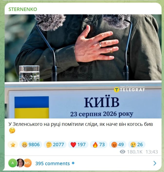 "Как будто кого-то бил", - на фото руки Зеленского заметили необычную деталь